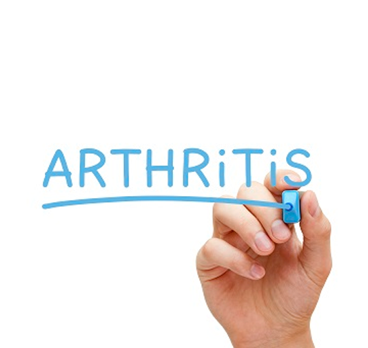 Arthritis