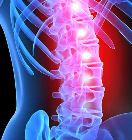Spinal Cord Trauma